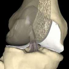 AVALIAÇÃO QUANTITATIVA DA ESTABILIDADE POSTURAL DINÂMICA BILATERAL E UNILATERAL EM PACIENTES COM LESÃO DO LIGAMENTO CRUZADO ANTERIOR DO