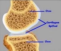 Tipos de Cartilagem CARTILAGEM HIALINA: