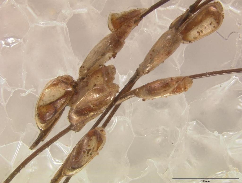 A B FIGURA 3. Fotos de várias lêndeas fixadas em fios de cabelo de múmias peruanas em (A) e de uma lêndea com um piolho que estava nascendo (B).