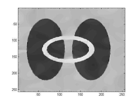 Levando em consideração (4), pode-se dizer que a junção dos métodos (2) e (9) apresentaram resultados satisfatórios no tratamento de imagens com alto nível de detalhes, como é o caso de imagens