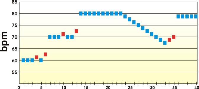 Metodologia 48 Fonte: Manual do Utilizador Integrity AfxDR modelo 5346, 2000. Figura 6. Exemplo do funcionamento do algoritmo de sobreestimulação dinâmica DAO (Dynamic Atrial Overdrive ).