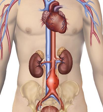 O que é um Aneurisma? Um Aneurisma é uma dilatação de uma artéria, localizada e permanente, superior a 50% do seu diâmetro normal. A Aorta é a maior artéria do organismo.