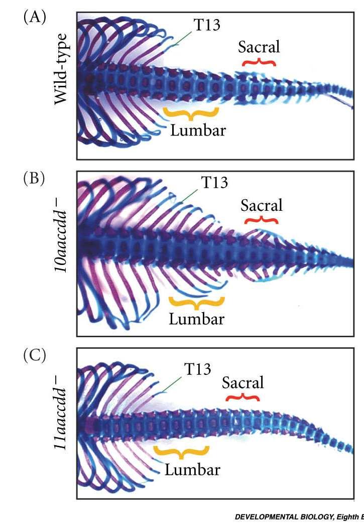 segmentos vertebrais