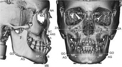 associando o maxilar superior à mandíbula (fig1).