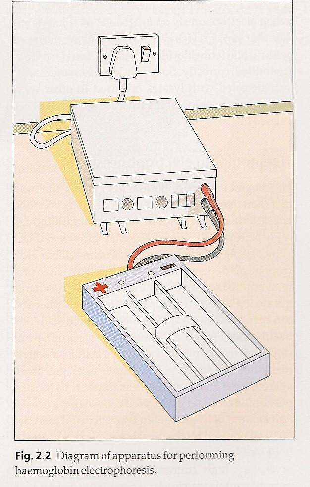 1 - ELECTROFORESE DE HEMOGLOBINAS Fundamento do método A separação eletroforéfca das hemoglobinas baseia- se nas caracterísfcas eléctricas das moléculas de globina, que podem estar carregadas