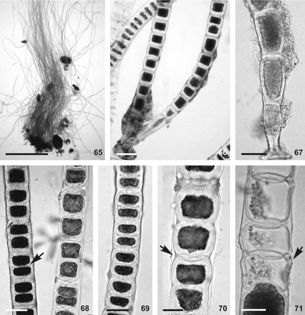 560 A. M. Alves et al.: Os gêneros Chaetomorpha e Rhizoclonium do litoral da Bahia 65 66 67 68 69 70 71 Figuras 65-71. Chaetomorpha nodosa. 65. Talo mostrando filamentos formando tufos frouxos. 66. Porção basal do talo.