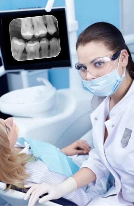 Radiologia Odontológica e suas aplicabilidades na Periodontia A doença periodontal é uma infecção bacteriana crônica causada por microrganismos gram-negativos