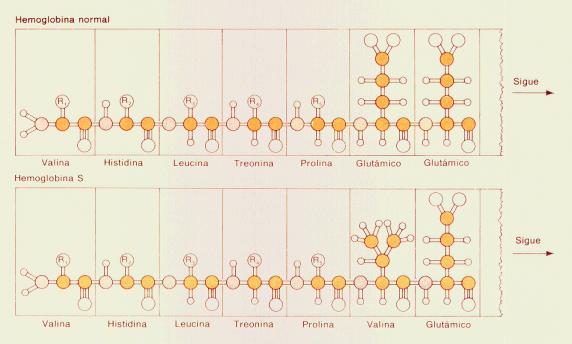 ANEMIA FALCIFORME Doença genética causada por uma única substituição de aminoácidos