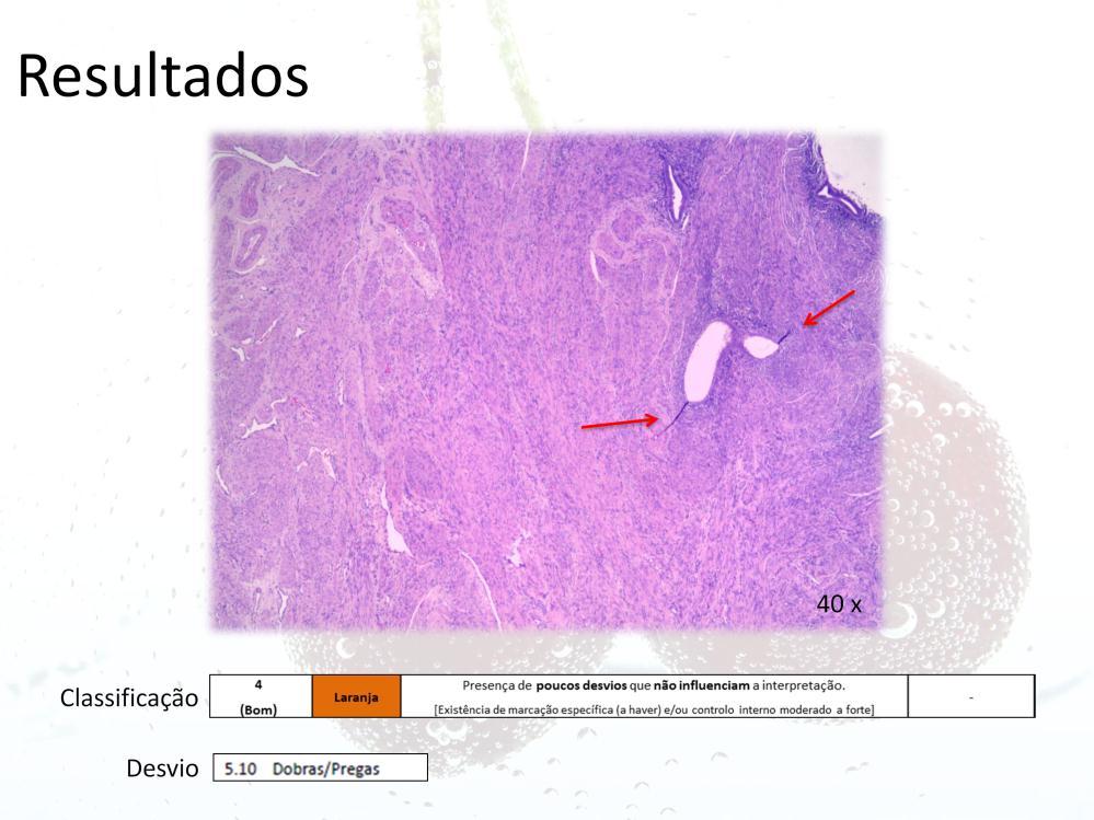 Exemplo: se numa lâmina de H&E se identificar uma ligeira prega que não influencia a