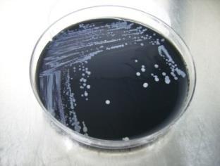 quantificação de Legionella por