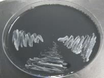 colónias suspeitas; Identificação Legionella pneumophila