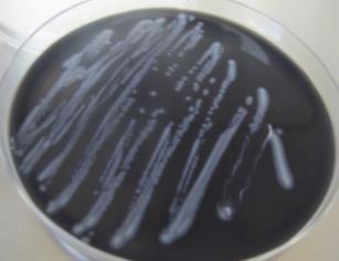 Legionella pneumophila Serogrupo 1