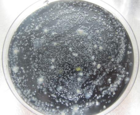Alguns dos casos positivos Homem de 50 anos infetado por Legionella pneumophila Seroprupo 1.