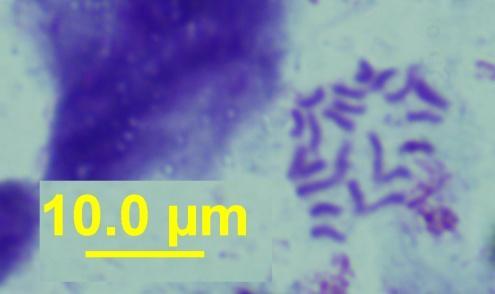 Figura 1 Metáfases de Mangaba (Hancornia speciosa Gómez) submetidas à coloração convencional com Giemsa. O índice CTC (Comprimento Total da Cromatina) obtido foi de 59,5 µm (± 2).