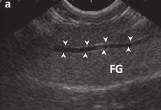 Ultra-sonografia do fígado, aparelho renal e reprodutivo da jibóia (Boa constrictor) 319