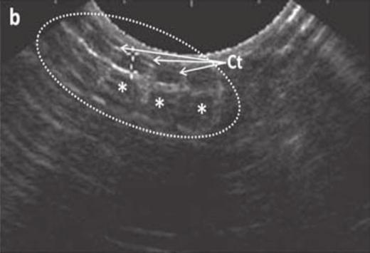 (a) e (b) Imagem ultra-sonográfica sagital do terço caudal da cavidade celomática da jibóia (Boa constrictor), demonstrando rins de formato elipsóide (círculo pontilhado), achatados