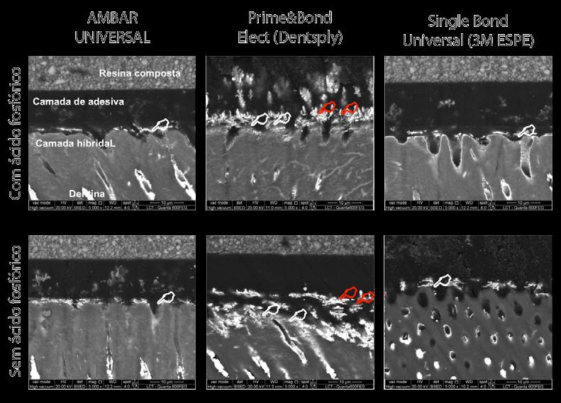 5. PRINCIPAIS CARACTERÍSTICAS E VANTAGENS Elevada adesão em diferentes modos: autocondicionante, ácido seletivo em esmalte ou condicionamento total; Indicado como primer de metais e cerâmicas;