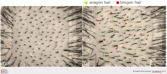 as Count'hair software utilizado para contar os fios de cabelo que estão em fase