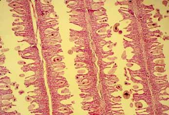 Na pele, não foram observadas alterações significativas; notou-se apenas raros trofontes de P. pillulare. No exame citológico do muco, P. pillulare e Henneguya spp. também foram evidenciados.