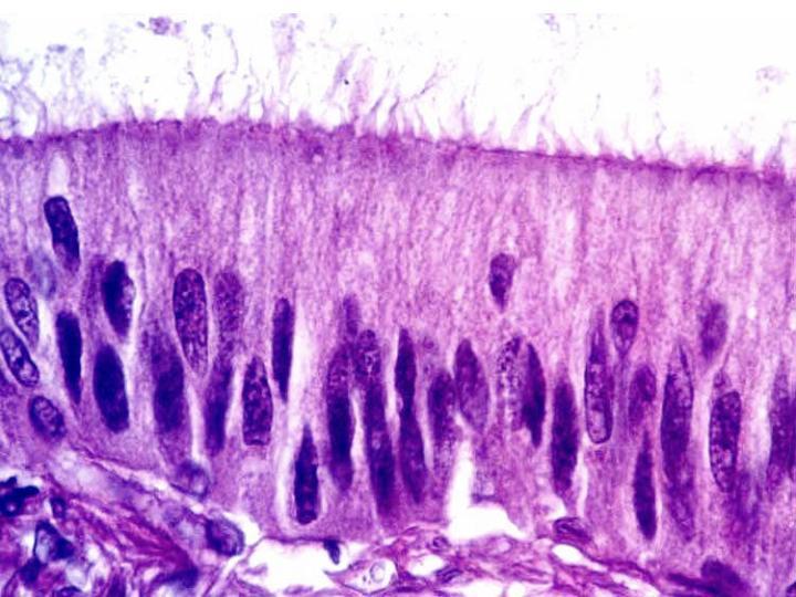 ESTEREOCÍLIOS Epidídimo e canal