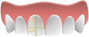 Critérios Básicos e Essenciais para a Finalização do Tratamento Ortodôntico ter um comprimento cérvico-incisal levemente maior que os incisivos laterais e igual ao dos caninos 7.