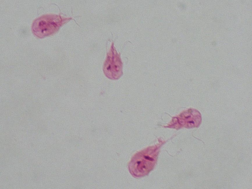 LAM Nº 13 Giardia duodenalis (forma trofozoíto)