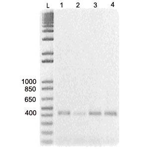 Resultados e Discussão Tetraodon nigroviridis DNA repetido clone C0AA29L14 Retrotransposon Rex6 AJ457054 AJ621034 70 69 Outro elemento transponível obtido por PCR a partir do DNA genômico de Cichla