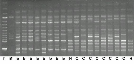 A? B Figura 3. Marcadores moleculares RAPD.