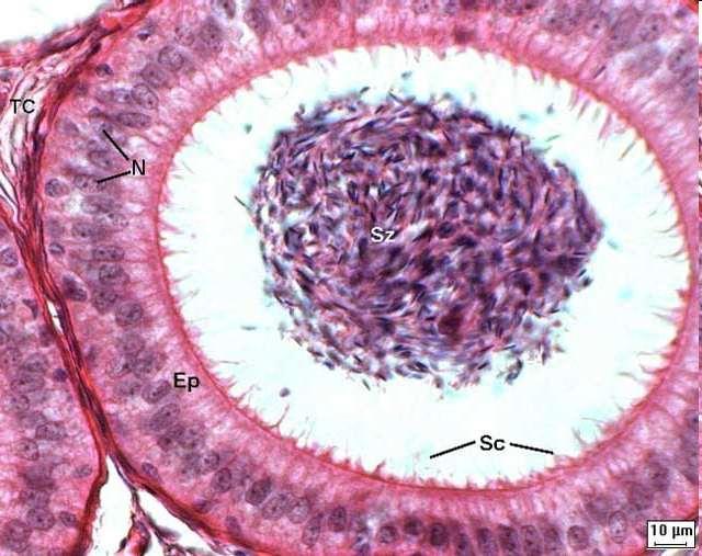 Estereocílios Estereocílios Estruturas de membrana semelhantes às