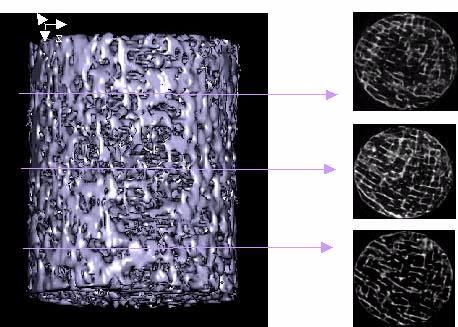 A partir de então, através do programa Reconv, desenvolvido no LIN, deu-se a reconstrução das microtomografias e, posteriormente sua visualização 3D utilizando o software comercial.