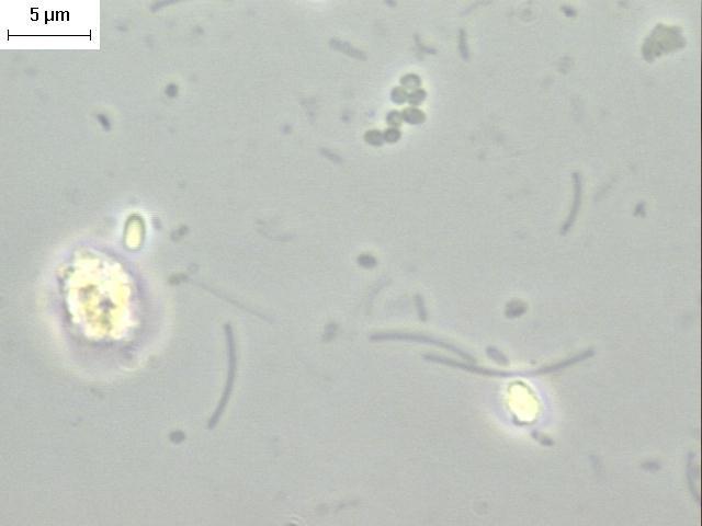 Methanosaeta (e) e diatomácea (f) (objetiva 100, ocular 10 e zoom