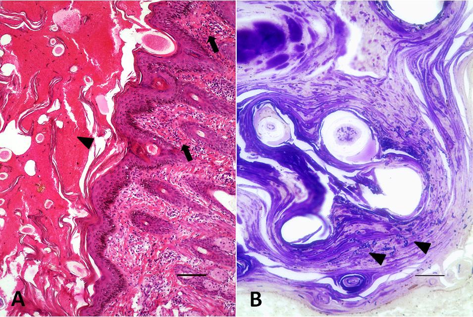 Figura 3. A- Dermatite superficial perivascular moderada (setas), acantose e abundante formação de crosta serocelular superficial (cabeça de seta) [H&E. Barra = 00 μm].