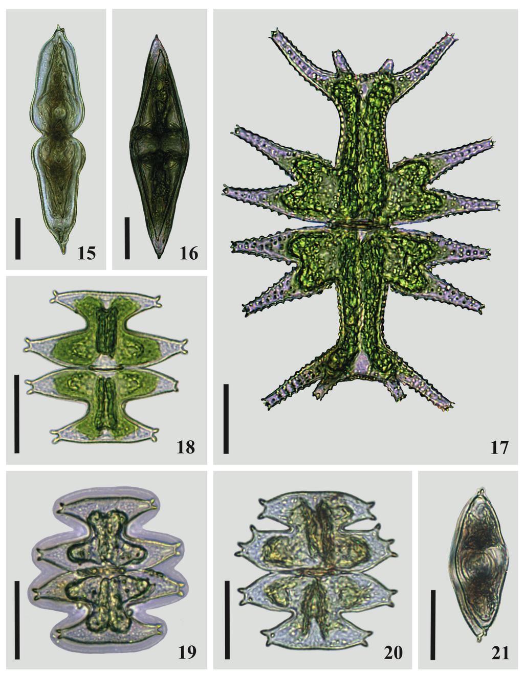 306 Santos et al. Figs. 15-21. 15, 16. Micrasterias laticeps var. laticeps. 15. vista lateral; 16. vista apical; 17. M. mahabuleshwarensis var.