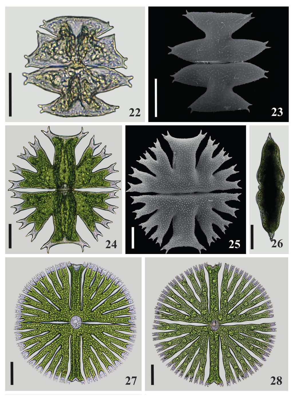 308 Santos et al. Figs. 22-28. 22, 23. Micrasterias pinnatifida var. pinnatifida. 22. variação morfológica; 23. ornamentação da parede celular (MEV); 24-26. M. radians; 24.