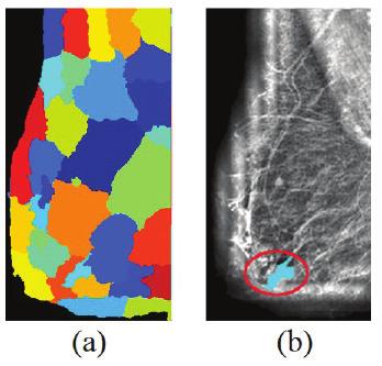 Detecção de massas em imagens Na etapa de descrição é realizada a extração de atributos dos grupos oriundos da etapa anterior para que posteriormente esses dados possam ser analisados e