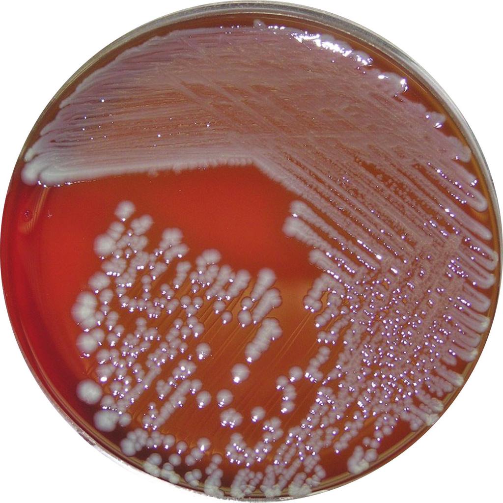 Figura 7.1: Escherichia coli Fonte: http://archive.microbelibrary.org/asmonly/details.asp?id=2038 7.2.7 Salmonellas São enterobactérias, Gram-negativas, não esporuladas.