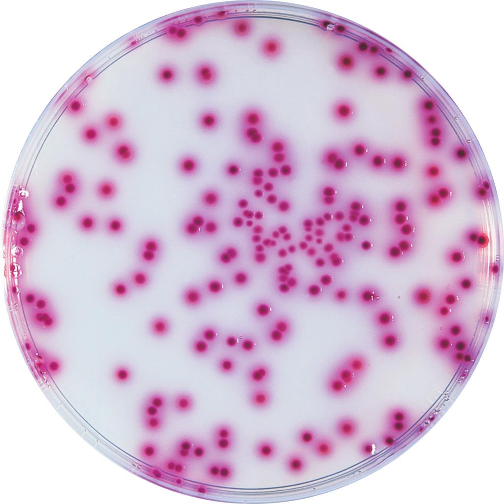 Figura 7.2: Salmonellas Fonte: http://www.solabia.fr/solabia/produitsdiagnostic.nsf/sw_prod/8af14c118957deb2c12574c90031dbbd?opendocu ment&lg=en& 7.2.8 Bacillus cereus São bactérias Gram-positivas, cuja faixa de ph para crescimento está entre 4,9 e 9,3.