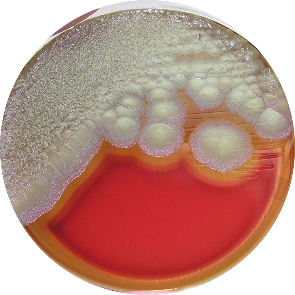 Figura 7.3: Bacillus cereus Fonte: http://archive.microbelibrary.org/microbelibrary/files/ccimages/articleimages/atlas-bld/bacillus%20