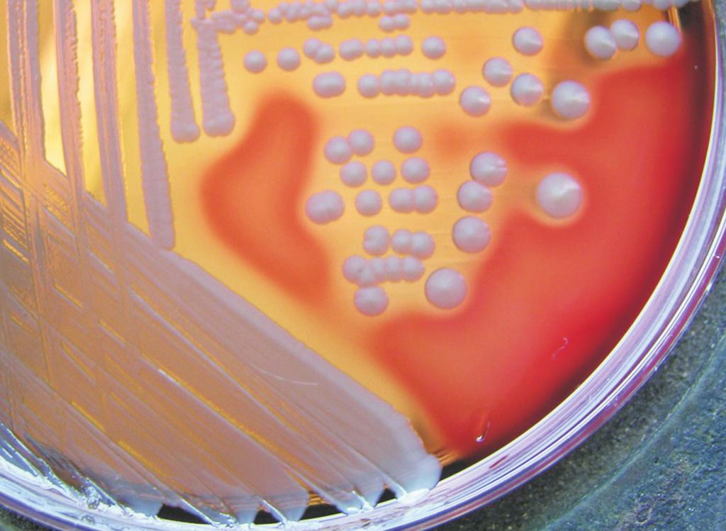 Figura 7.4: Staphilococcus aureus Fonte: http://archive.microbelibrary.org/asmonly/details_print.asp?id=2040&lang= 7.
