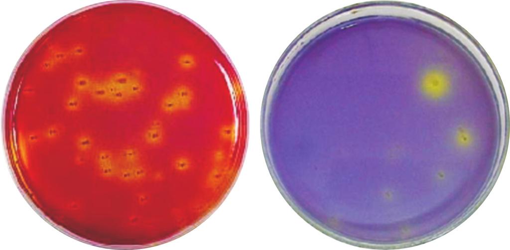Figura 7.8: Colônias de bactérias produtoras de flat-sour Fonte: Godoy, 2005 7.3.