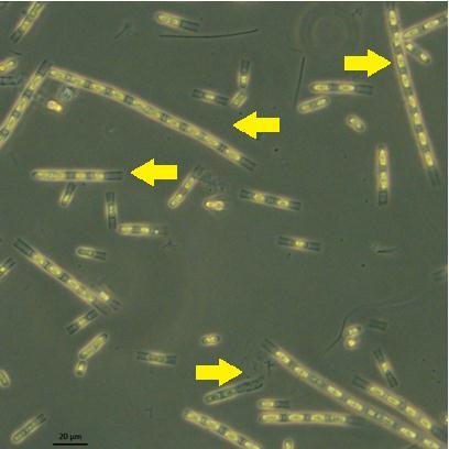Abundância (orgnismos. ml -1 X10 5 ) Figura 6: Planctonema sp.