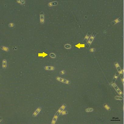 Abundância (orgnismos. ml -1 X10 5 ) Oocistis sp. (Fig. 9) também esteve presente no meio de cultivo.