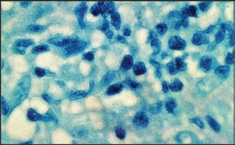 28 Charles A. Janeway, Jr., Paul Travers, Mark Walport & Mark J. Shlomchik Figura 1.26 Mecanismos de defesa do hospedeiro contra infecções intracelulares por micobactérias.