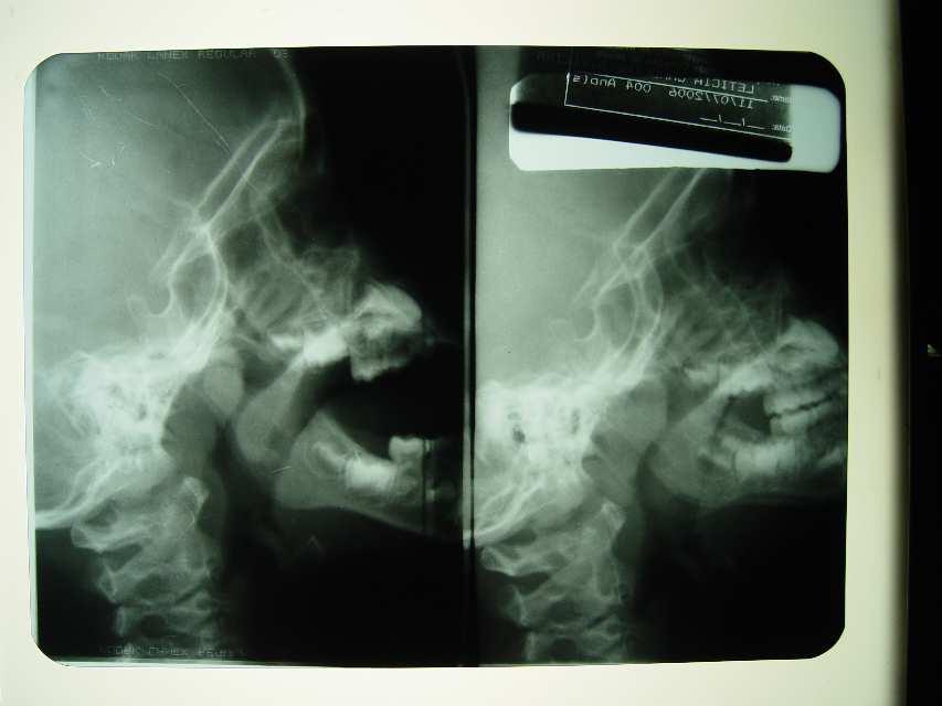 Figura 1- radiografia