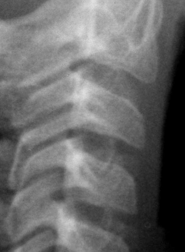 Figura 2- radiografia da região