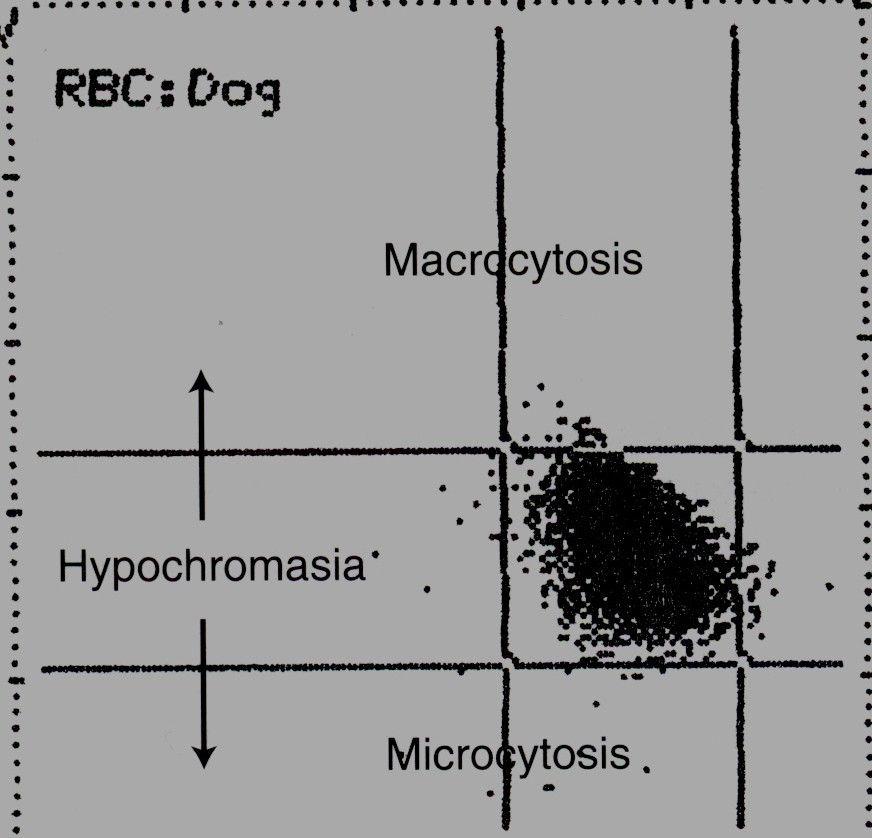 Hipocromasia Microcitose Anemia normocítica