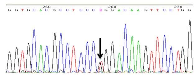 Caraterização molecular e funcional de variantes alfa de hemoglobina identificadas no Centro Hospitalar e Universitário de Coimbra Tabela 6: Parâmetros hematológicos apresentados pelos indivíduos