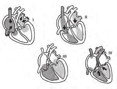 16 (( ) A hipertensão, o diabetes, o fumo e a obesidade são fatores de risco para doenças cardiovasculares.