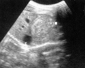 VB AI E FIGURA 19 Imagem ultra-sonográfica de gestação com 58 dias