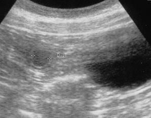 Trabalho Científico 13 fetus, aende fetal membranes throughout accurately timed pregnancy in beagles. American Journal Veterinary Research, v. 53, n.3, p. 342 351, 1992.